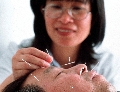 Acupuncture: What’s It Good For — Or Not? Acupuncture: What’s It Good For — Or Not?