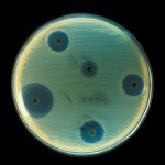 Antibiotics: Does Your Child Get Too Many?