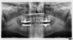 Are Routine Dental X-rays Dangerous?