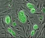 Amazing PM2.5 Breakthrough, & Stem Cell Crackdown