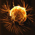 Cancer Update: Screening & Healing