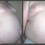 Obesity in Childhood: How To Stop the Epidemic?